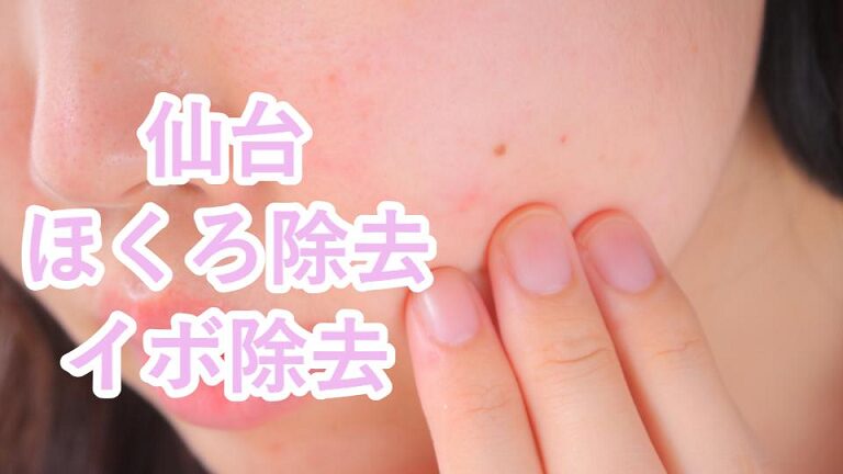 仙台のほくろ取り