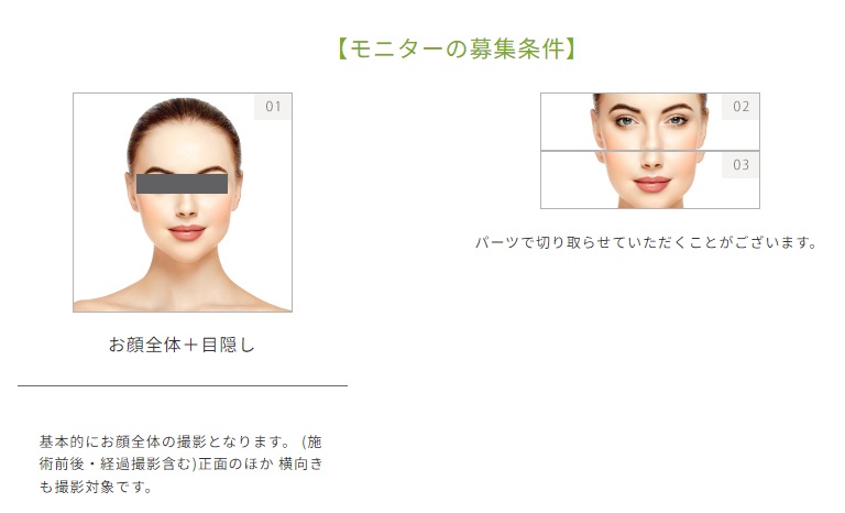 シミ取り無料モニターについて