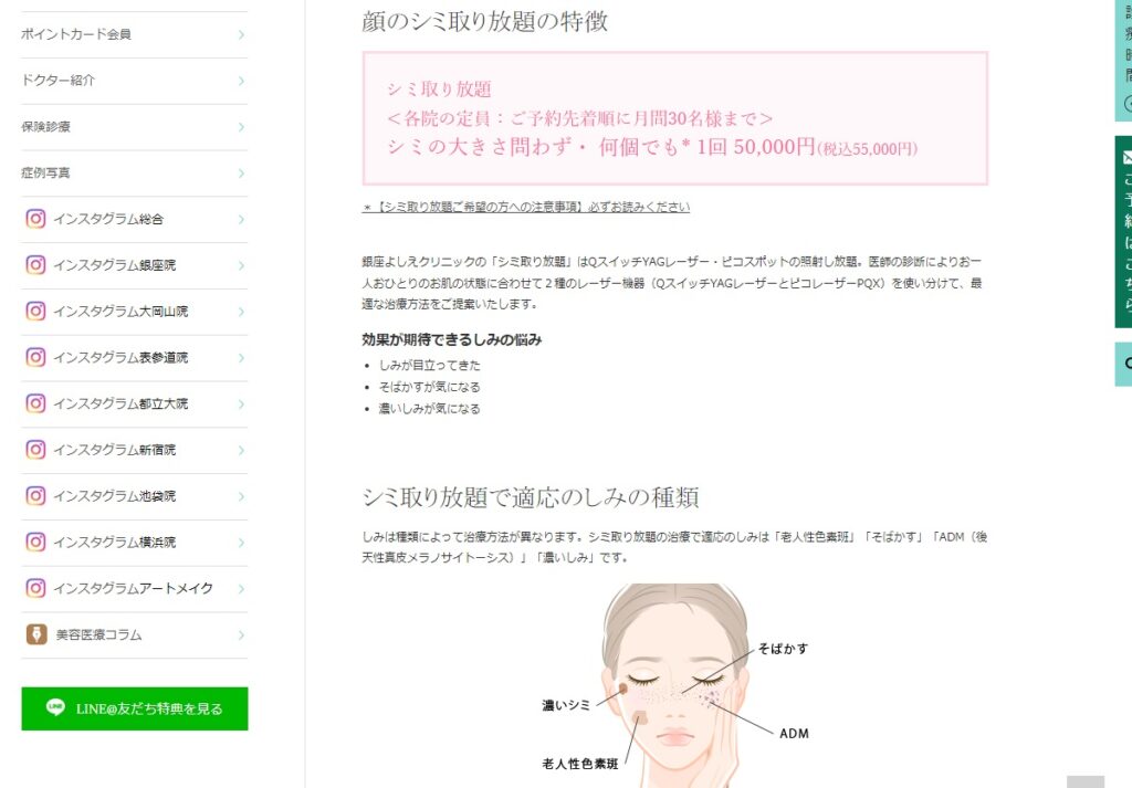 銀座よしえクリニックのシミ取り放題について