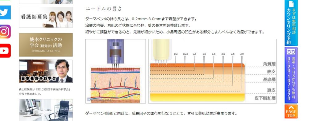 城本クリニックのダーマペン（深さ）